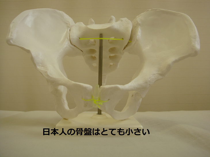 日本人女性の骨盤