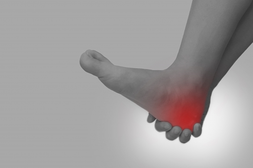 足底腱膜炎の痛み