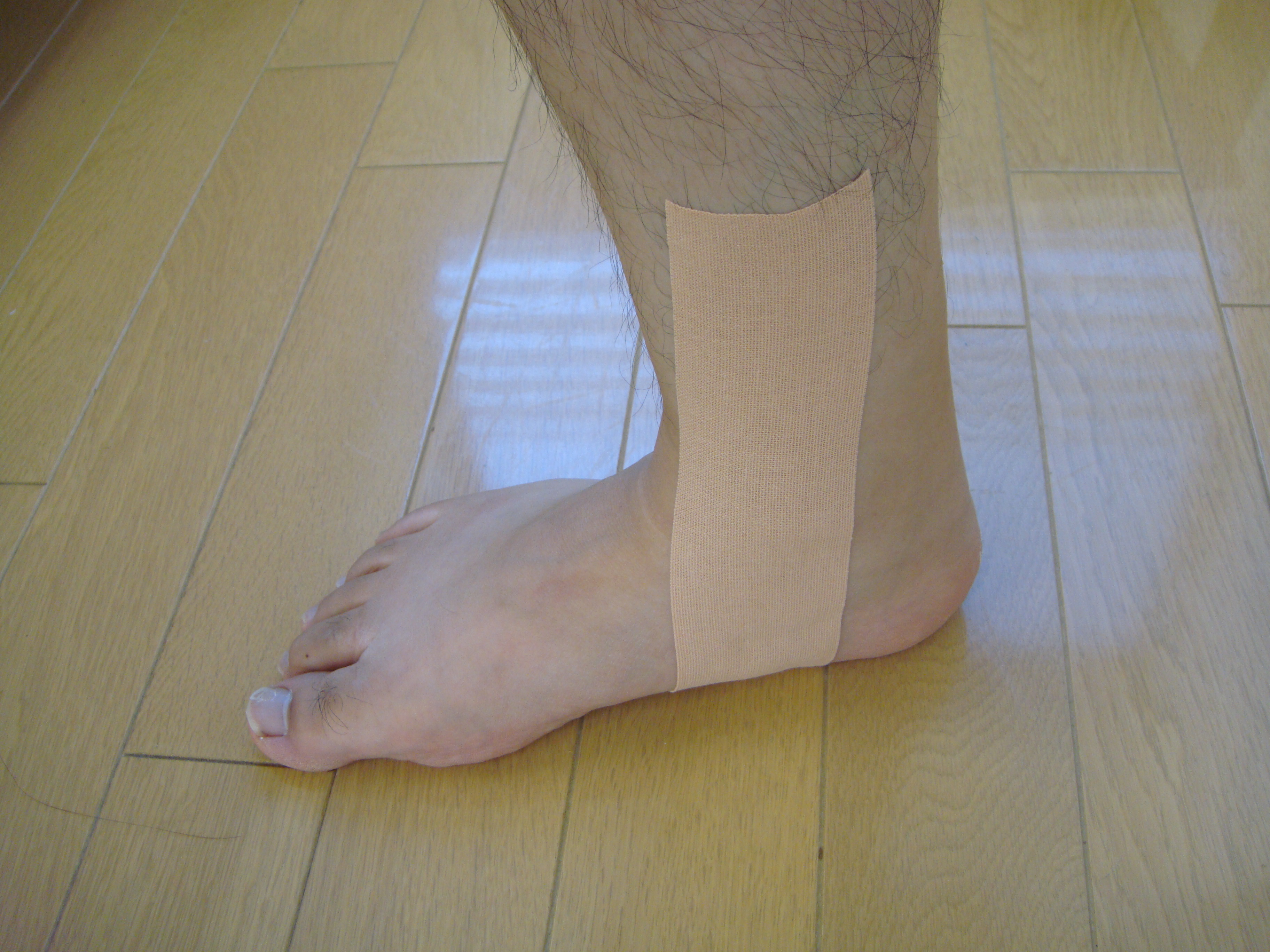 有痛性外脛骨のテーピング方法を福井県坂井市の整体師が解説
